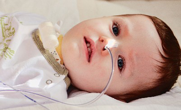 سندروم گیلن- باره