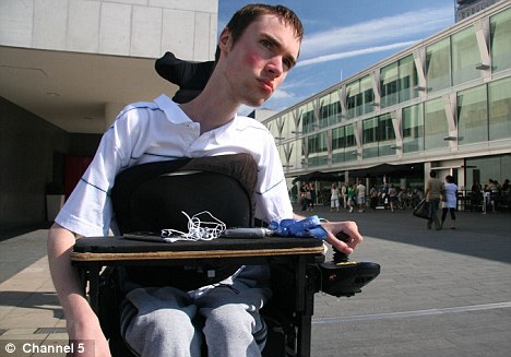 از هر ٣٥٠٠ نوزاد پسر، یک نفر به دوشن مبتلا می‌شود