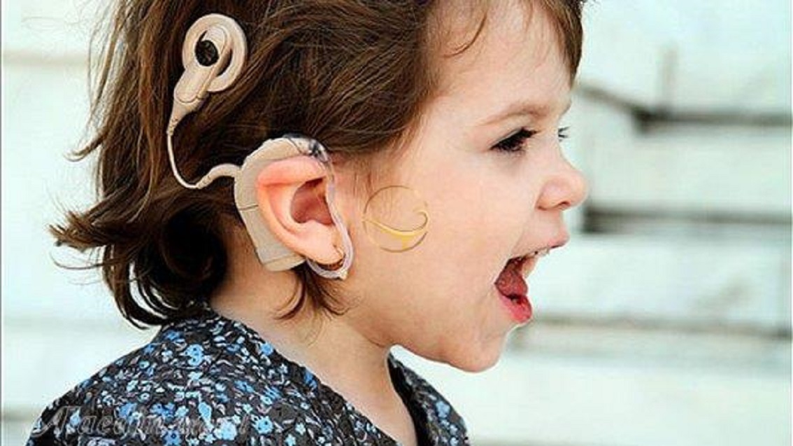 مراکز کاشت حلزونی شنوایی