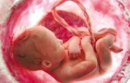 غربالگری ژنتیک جنین حذف نشده است